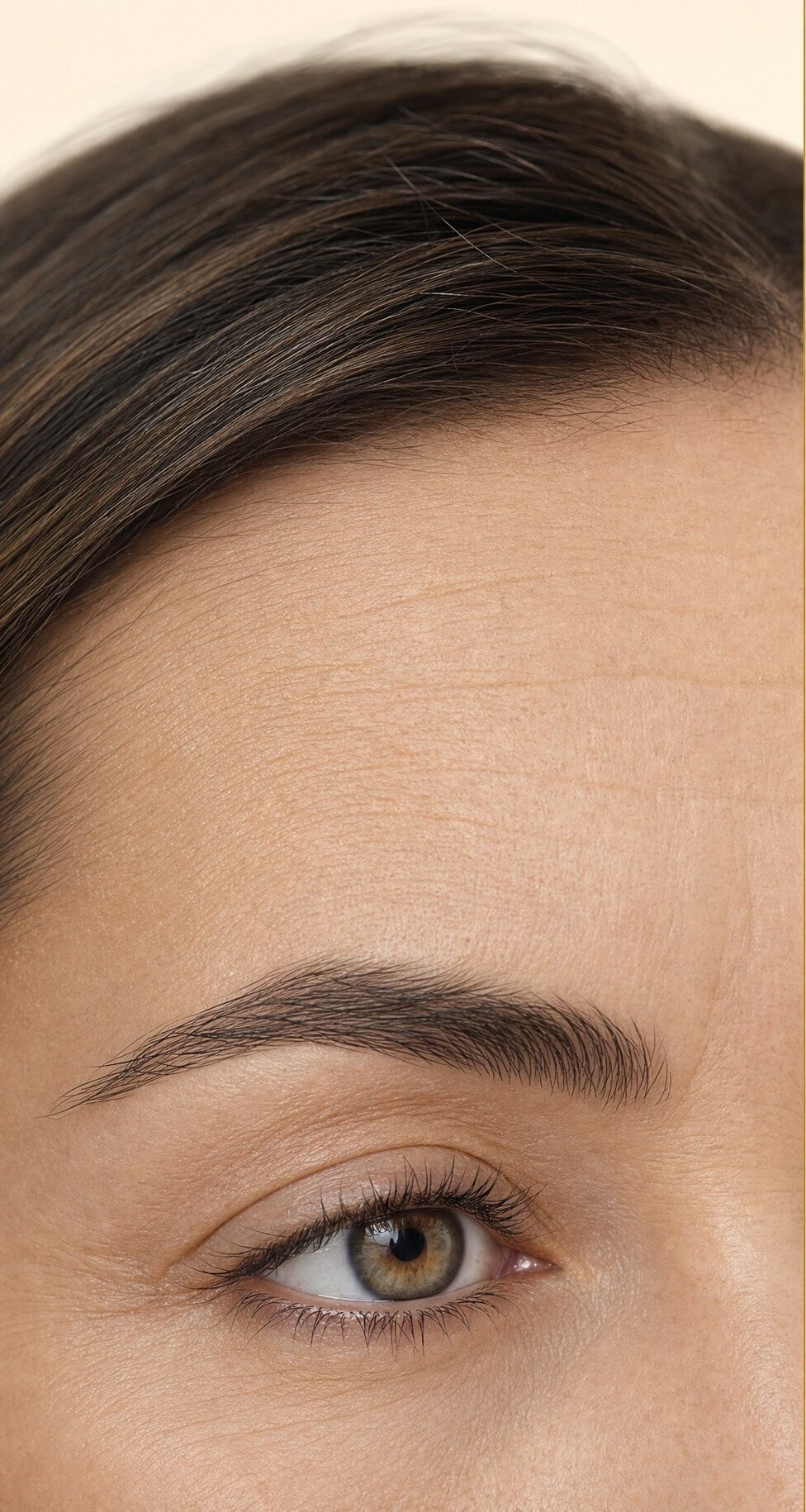 Wrinkle depth reduced by 63% after 28 days — Before